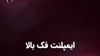 ایمپلنت دندان