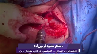 جراحی استئوتومی پری استابولار