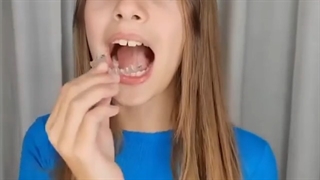 چرا بزرگسالان مجذوب ارتودنسی نامرئی میشوند؟ | کلینیک تخصصی دندانپزشکی کانسپتا