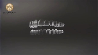ارتودنسی نامرئی | دکتر فرهاد گرجی دوز