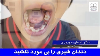 دندان شیری را بی مورد نکشید | دکتر احسان مهریزی