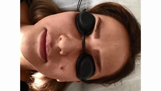 فیلم پاک کردن تاتو با لیزر