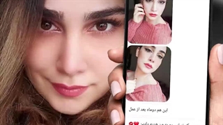نمونه کار بهترین جراح بینی تهران
