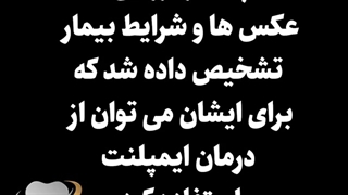 جایگزینی دندان های از دست رفته مراجعه کننده عزیزمون | دکتر حامد صالحی