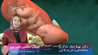 زایمان طبیعی اجباری یا سزارین اختیاری