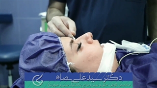 فیلم جراحی بینی استخوانی