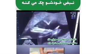فیلم واقعی جنینی که با دقت نبض خودشو چک می کنه