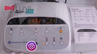 فیلم زایمان سزارین از رو به رو