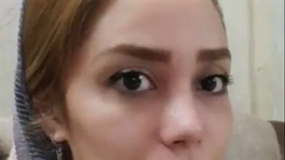 نتیجه جراحی بینی بعد از یکماه