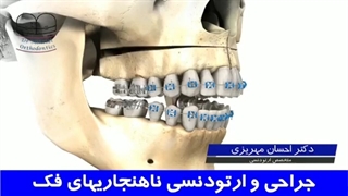 جراحی و ارتودنسی ناهنجاریهای فک | دکتر احسان مهریزی