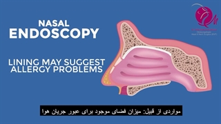 فیلم آندوسکوپی بینی