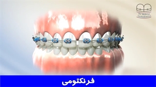 فرنکتومی | دکتر احسان مهریزی