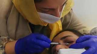 انجام مزوتراپی دور چشم توسط خانم دکتر ناهید همتیان متخصص پوست، مو وزیبایی درکلینیک تخصصی جُوان لیپوساکشن