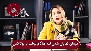 فیلم درمان لبخند لثه نما با تزریق بوتاکس