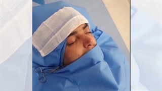 فیلم جراحی بینی مردانه گوشتی و دارای انحراف