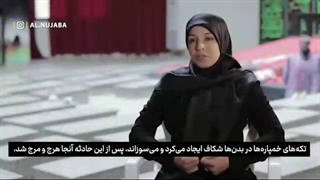 قانا به رنگ ارغوان جراحی بینی