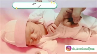 انجام زایمان به روش سزارین