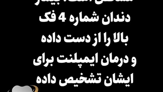 روند درمان ایمپلنت در یک جلسه | دکتر حامد صالحی