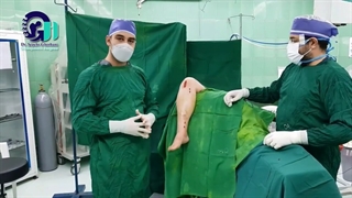 جراحی شکستگی دوبل ساق پا