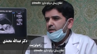 ‏آلر گارد، داروی تسکین دهنده عوارض جانبی ابتلا به ویروس کرونا