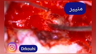 منییر گوش