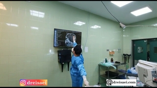 جراحی رزکسیون کامل تومور مننژیوما در خانم 60 ساله