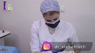 تزریق چربی صورت رفع چین و چروک