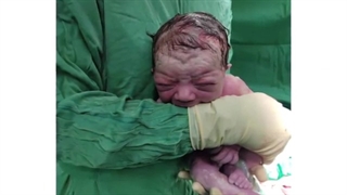 فیلم عمل سزارین