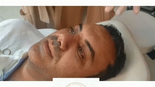 جراحی همزمان لیفت پیشانی و جراحی بینی گوشتی