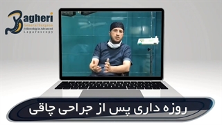 آیا بعد از جراحی چاقی می توان روزه گرفت؟