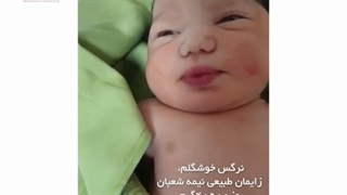 عمل زایمان سزارین