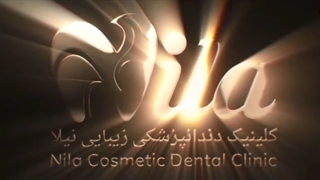 کامپوزیت دندان