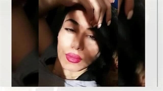 معرفی دکتر خوب برای عمل بینی