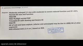 تفسیر جواب اکوی قلب