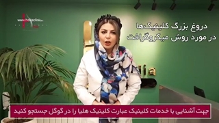 مستند کاشت مو به روش میکروگرافت (دروغ کلینیک ها) - قسمت اول