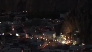 ماندگاری دندان مصنوعی