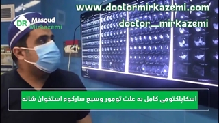 فیلم خارج سازی تومور سارکوم شانه