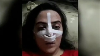 رضایت از عمل جراحی بینی