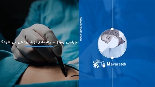 سوالات متداول پروتز سینه