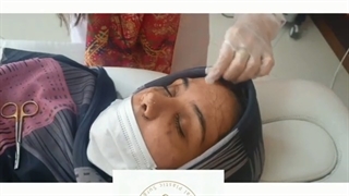 عمل بینی