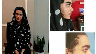 فیلم جراحی زیبایی بینی - رضایت بیمار