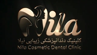 پرکردن دندان