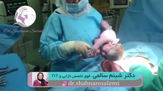 فیلم کامل زایمان سزارین بدون سانسور