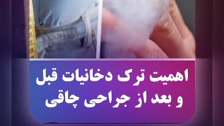 اهمیت ترک دخانیات قبل و بعد از جراحی چاقی
