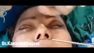 عمل سانترال لیفت لب (کاهش ارتفاع پشت لب)