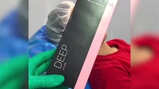 تزریق  ژل خط خنده