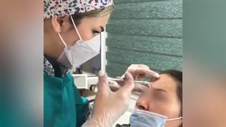 فیلم تزریق بوتاکس پیشانی