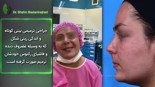 ویدئوی جراحی ترمیمی بینی کوتاه و زینی شکل | دکتر باستانی نژاد | جراح بینی تهران