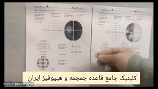 جراحی تومور هیپوفیز بزرگ