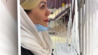 3 ماه بعد از جراحی زیبایی بینی